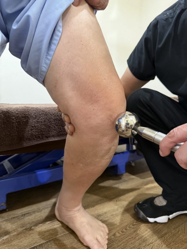 立位での膝治療
